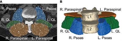 Lumbopelvic Muscle Changes Following Long-Duration Spaceflight